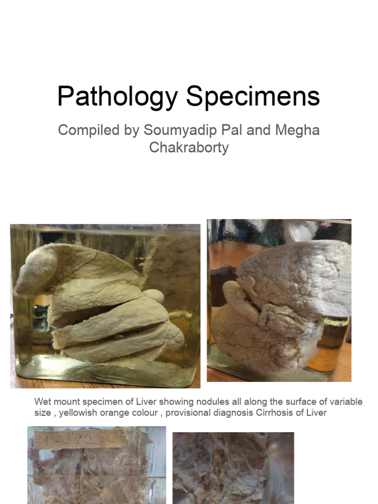 Pathology Specimens Final | PDF | Kidney | Ovary