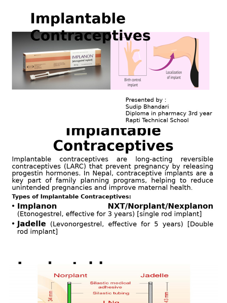Overview of Implantable Contraceptives in Nepal | PDF | Birth Control ...