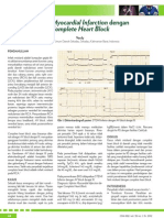 13 - 189inferior Myocardial Infarction Dengan Complete Heart Block