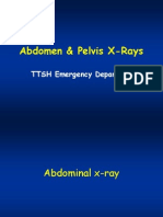 Abdomen & Pelvis Xrays