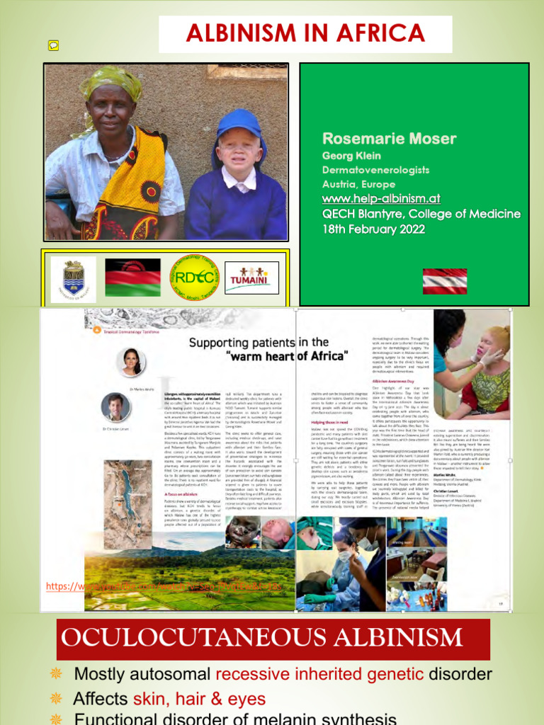 Albinism Challenges and Care in Africa | PDF | Skin Cancer | Medical ...