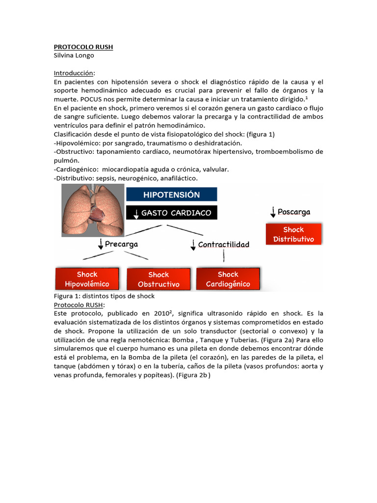 Protocolo RUSH para Diagnóstico de Shock | PDF | Corazón | Vena