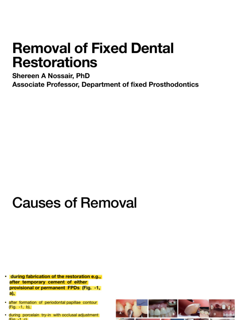 Removal | PDF | Dentistry Branches | Dentistry