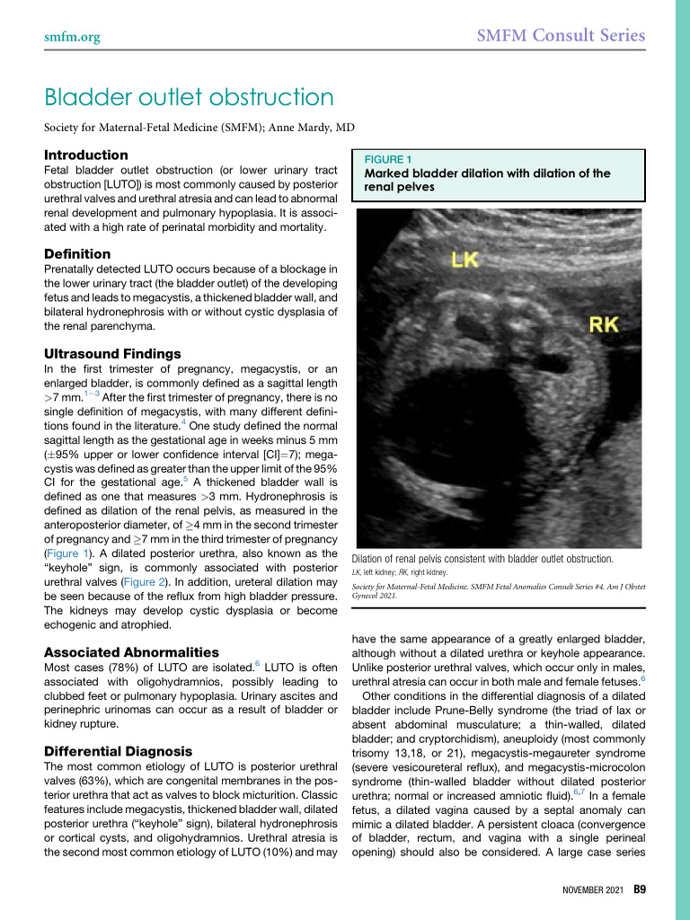 Bladder Outlet Obstruction 2021 Ymob | PDF | Medical Specialties ...