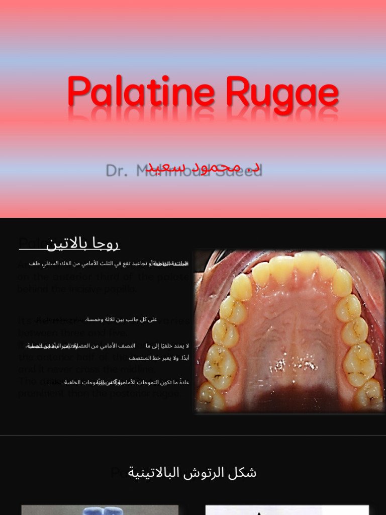 Rugae Area | PDF