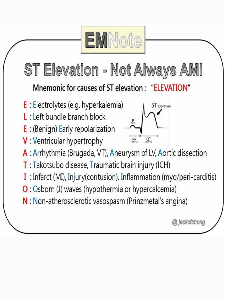 Myocadial Infarction Notes | PDF