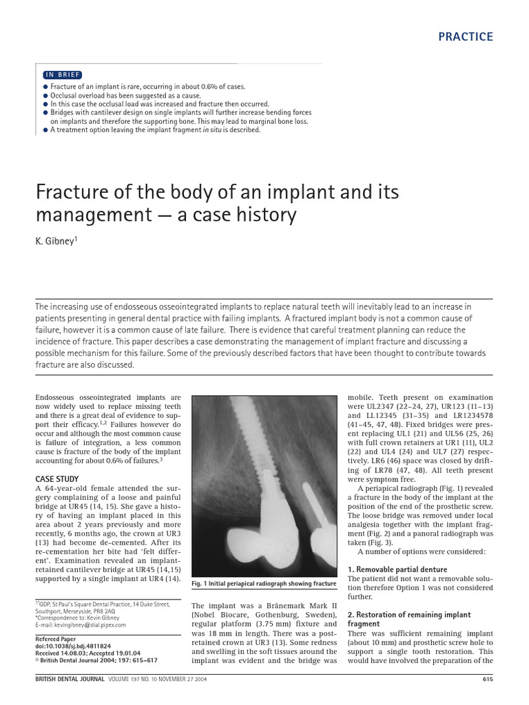 Managing Fractured Dental Implants | PDF | Dental Implant | Mouth