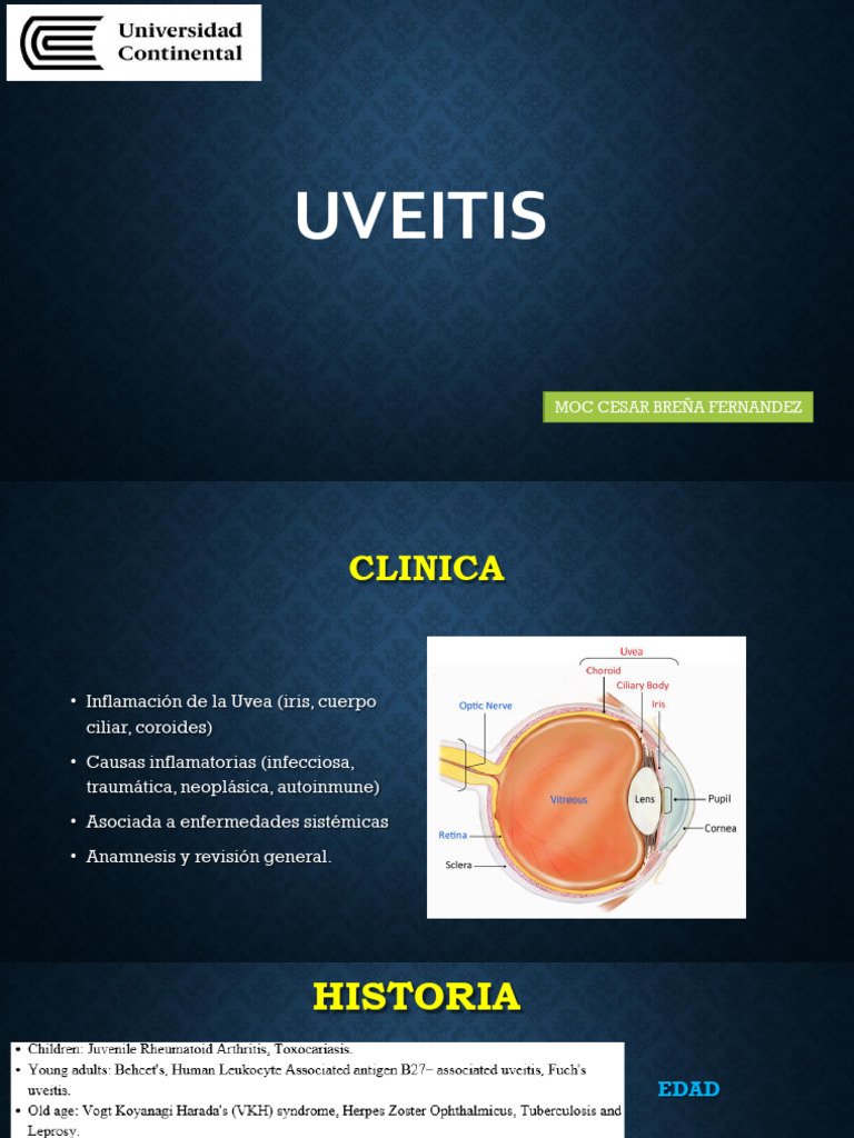 Guía Completa sobre Uveitis: Causas y Tratamiento | PDF | Oftalmología ...