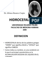 Hidrocefalia: definición, fisiopatología, etiología, clínica y tratamiento