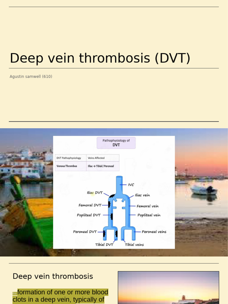 Understanding Deep Vein Thrombosis (DVT) | PDF | Thrombosis | Vein