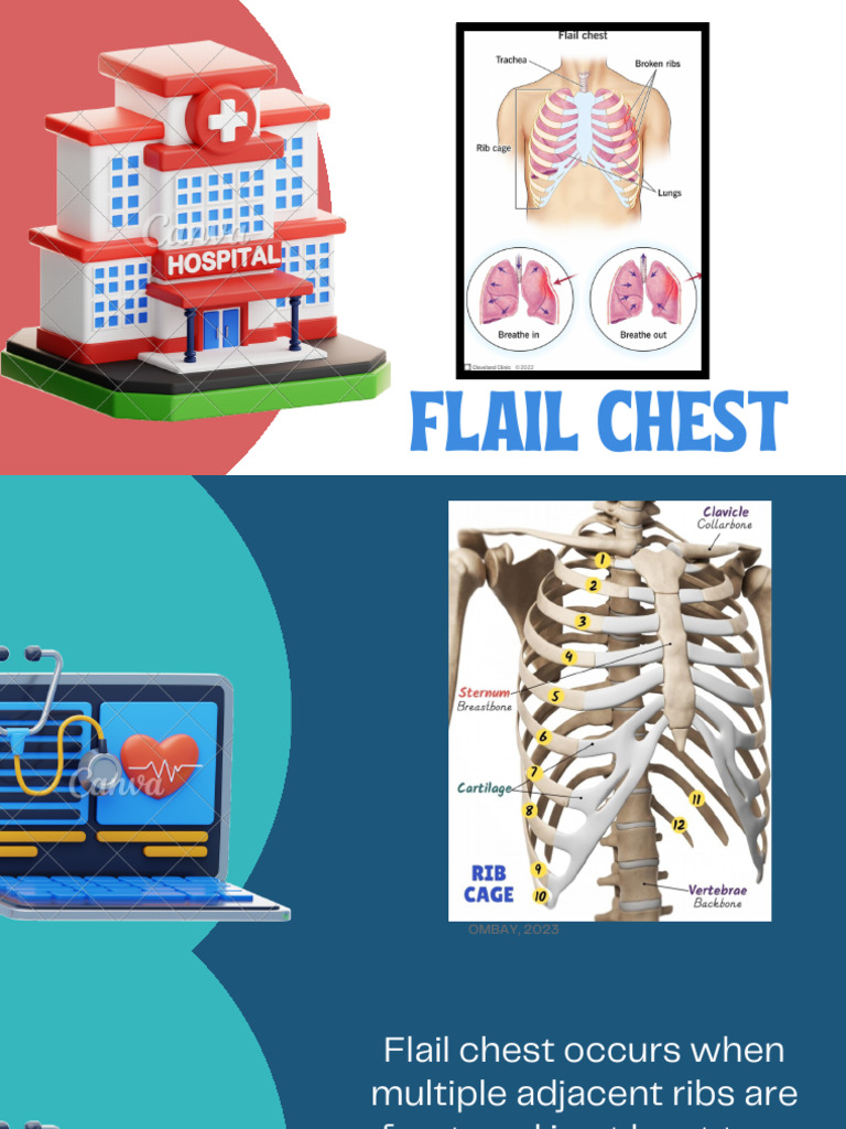 Flail Chest Nursing Interventions Guide | PDF | Thorax | Breathing