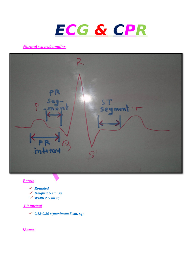 Normal P Wave Characteristics in ECG | PDF | Cardiopulmonary ...