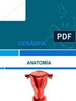 Cesarea