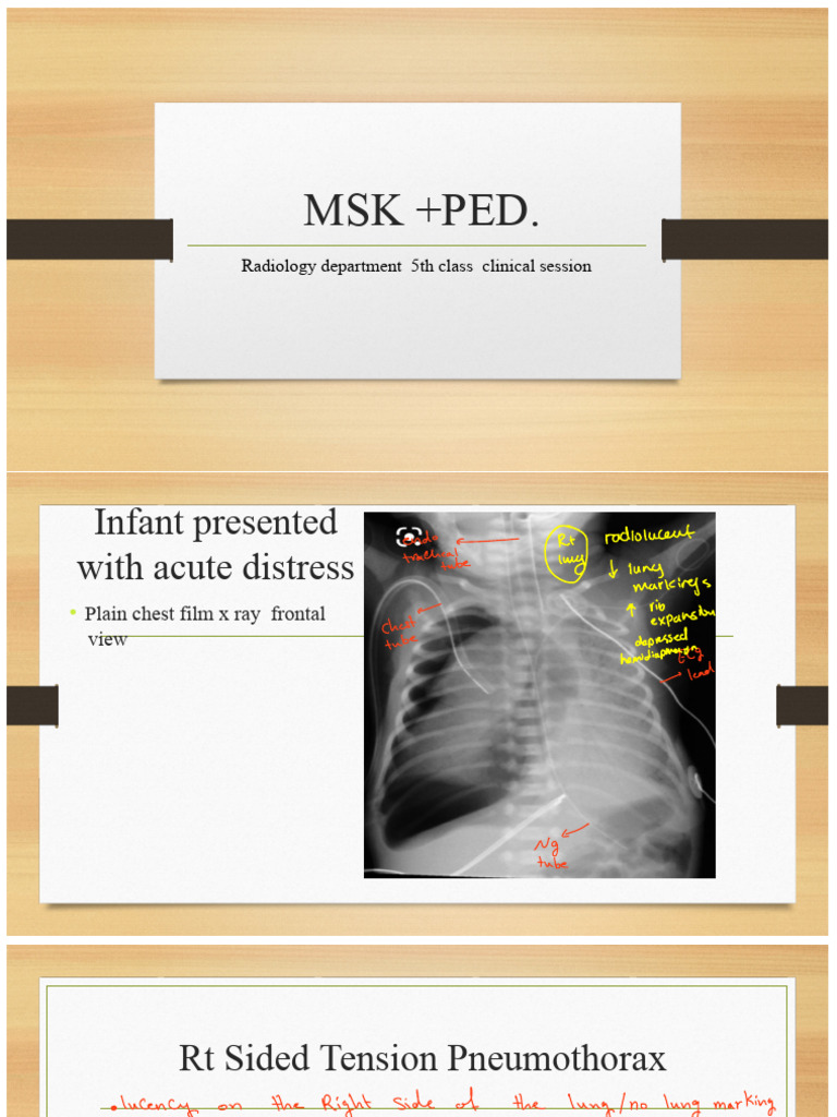 MSK + PED | PDF | Vertebra | Medical Specialties
