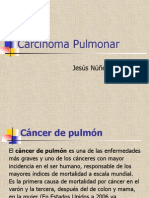Carcinoma de Pulmon