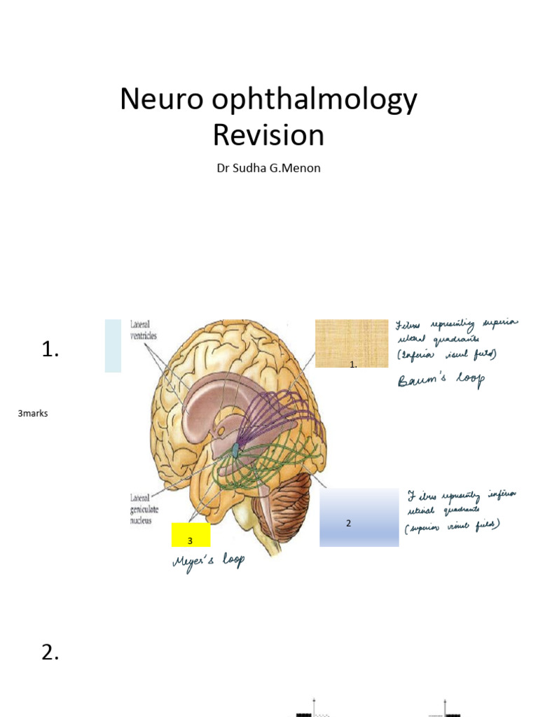 Neuro Ophthal | PDF