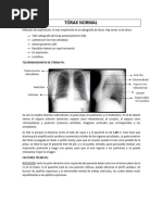 Radiografía Normal de Tórax: Anatomía y Criterios | PDF | Tórax | Pulmón