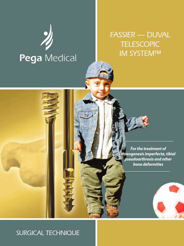 Fassier-Duval Nail Surgical Technique | PDF | Screw | Skeletal System