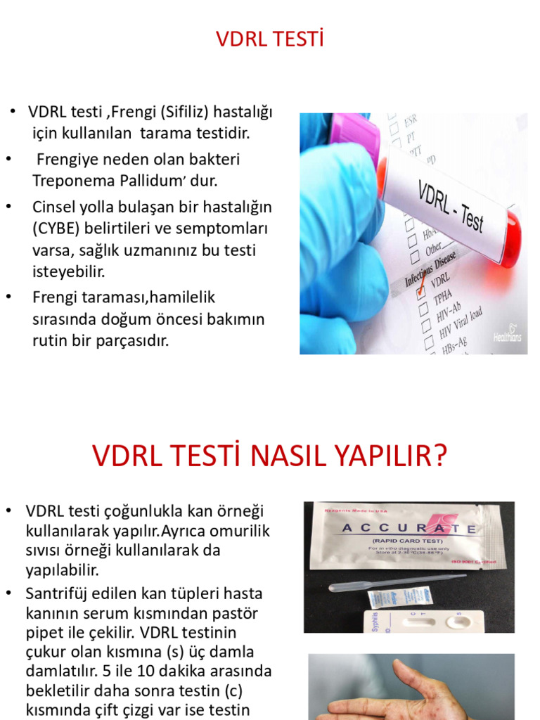 VDRL | PDF