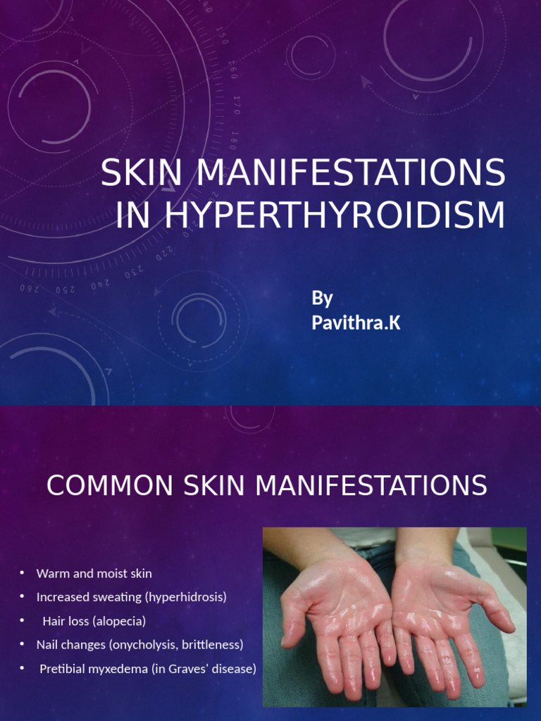 Skin Signs of Hyperthyroidism Explained | PDF
