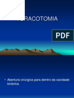 TORACOTOMIA