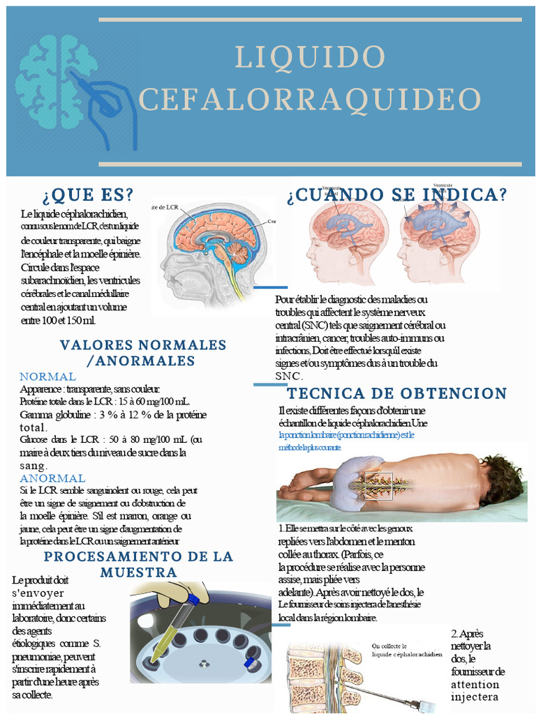 Comprendre le liquide céphalorachidien | PDF | Liquide cérébro-spinal ...