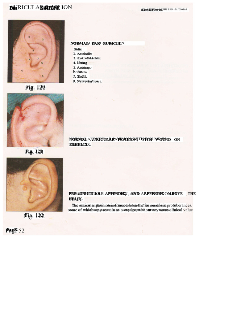 Anatomy and Malformations of the Ear | PDF | Ear | Diseases And Disorders