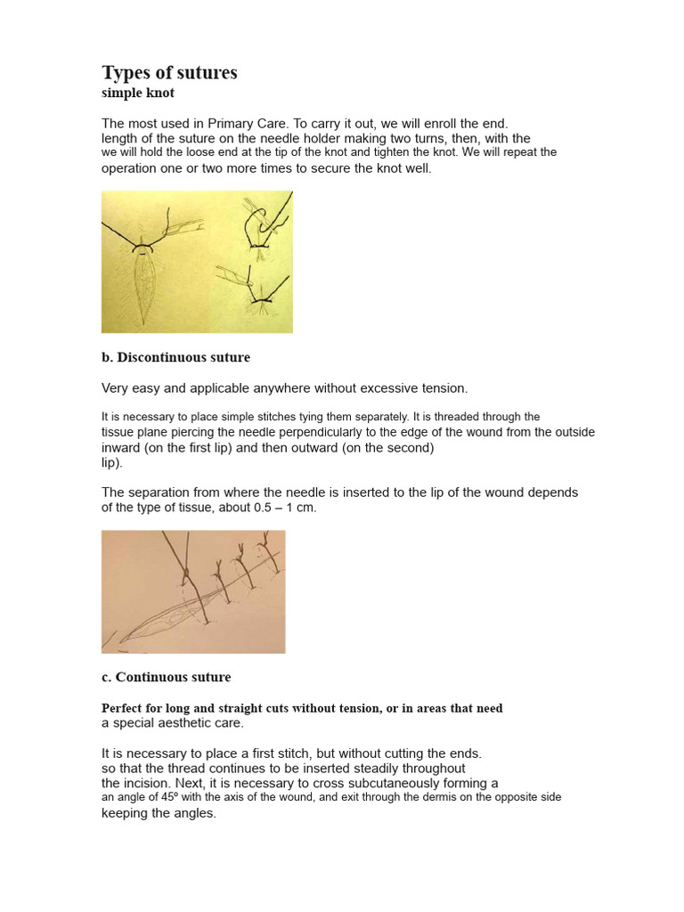 Guide to Suture Techniques and Types | PDF | Surgical Suture | Wound