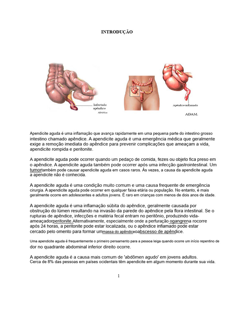 Apendicite Aguda | PDF | Medicina Clínica | Especialidades médicas