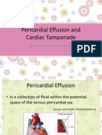 Pericardial Effusion and Cardiac Tamponade