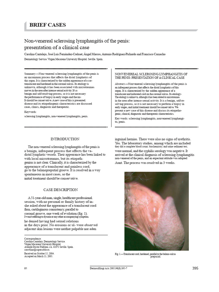 Non-Venereal Sclerosing Lymphangitis of The Penis | PDF | Medical ...