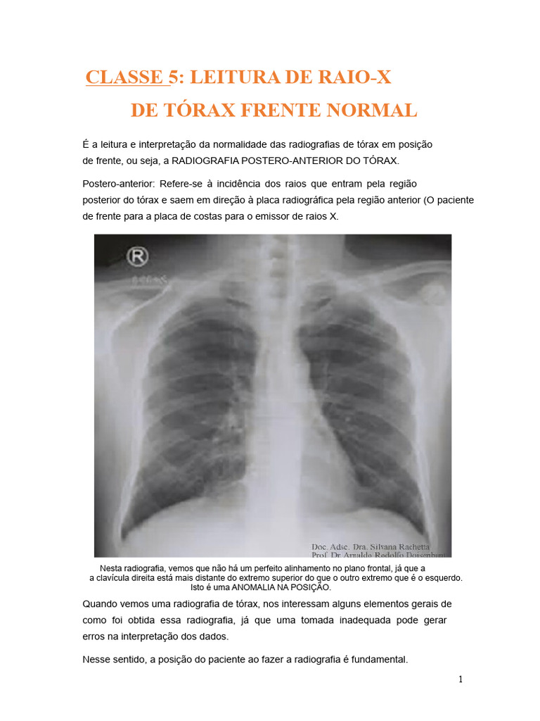 Leitura de Raio-X de Tórax Normal | PDF | Ventrículo (coração ...