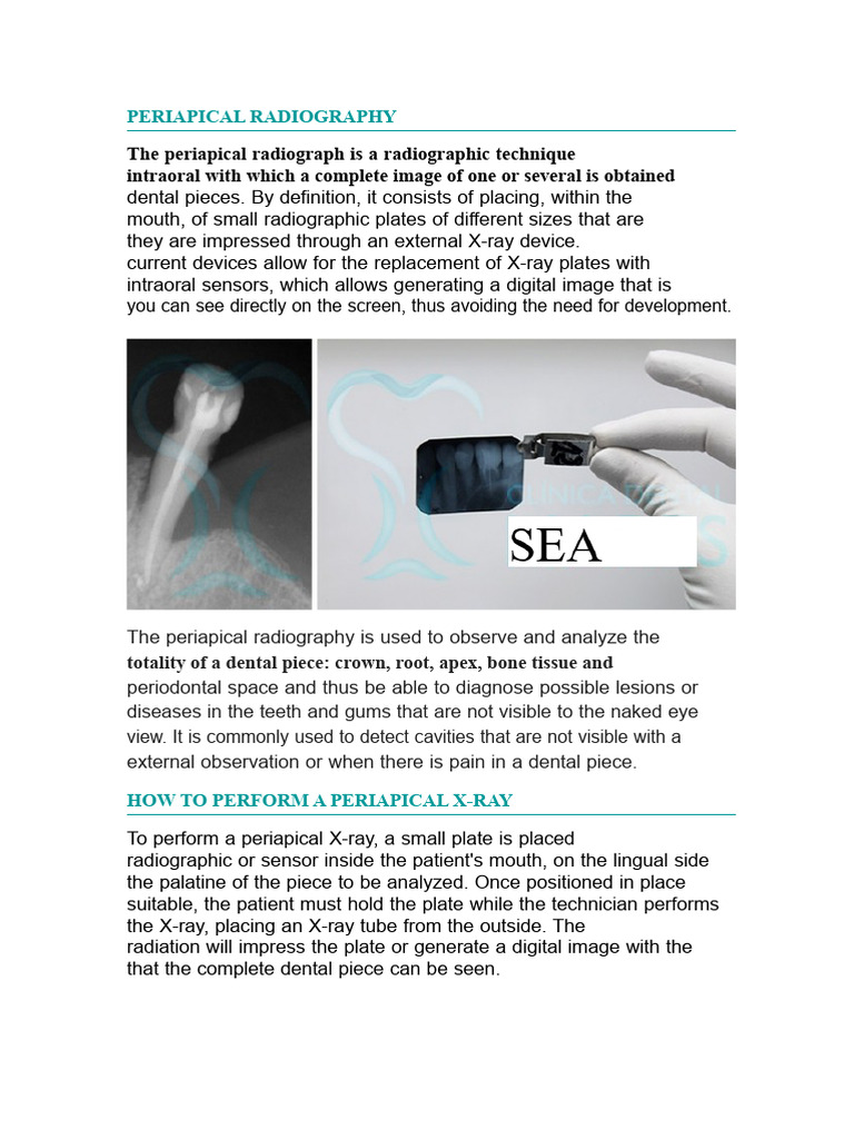 Periapical Radiograph | PDF | Radiography | X Ray