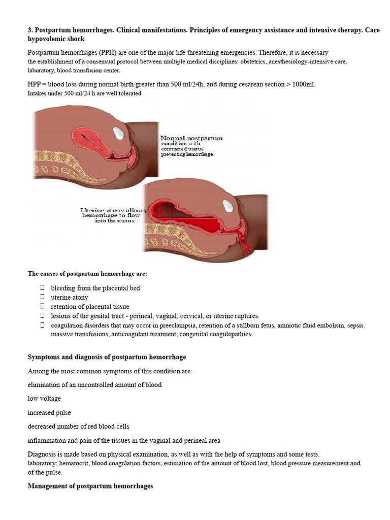 Postpartum Hemorrhage Management Guide | PDF | Bleeding | Shock ...