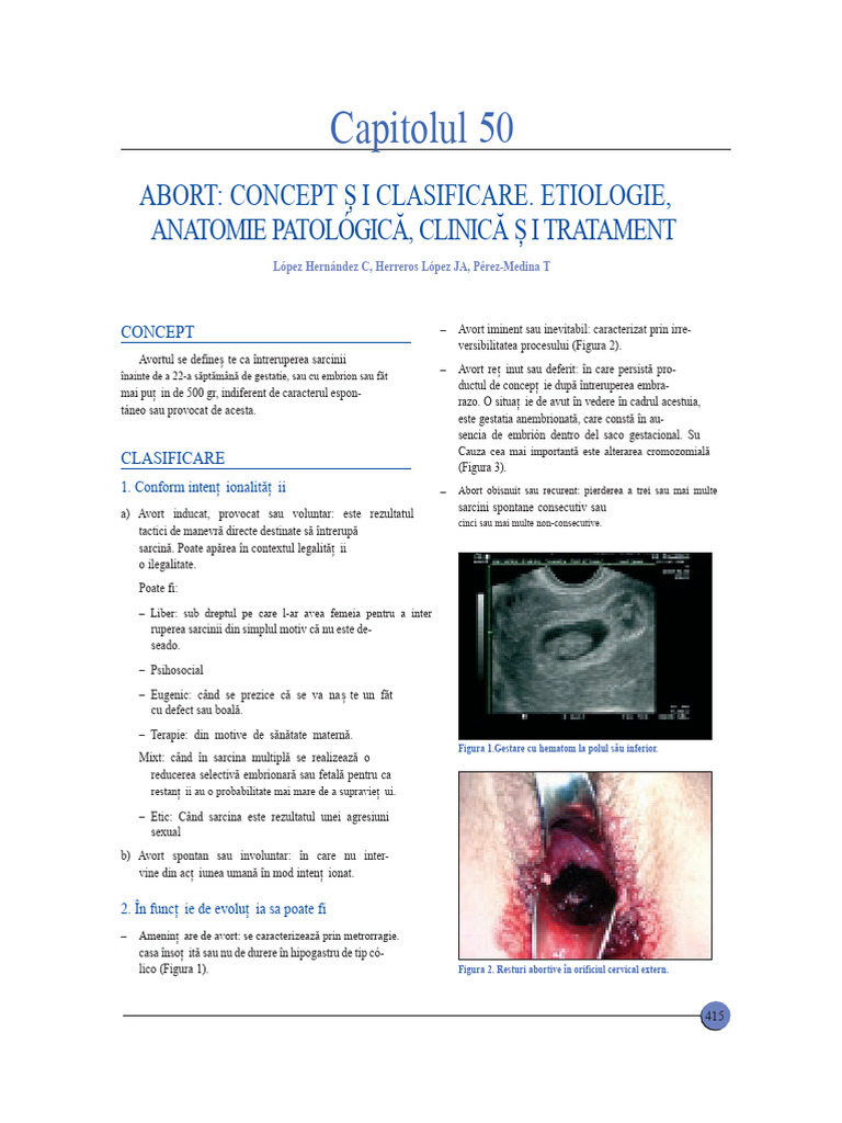 Avort SEGO | PDF