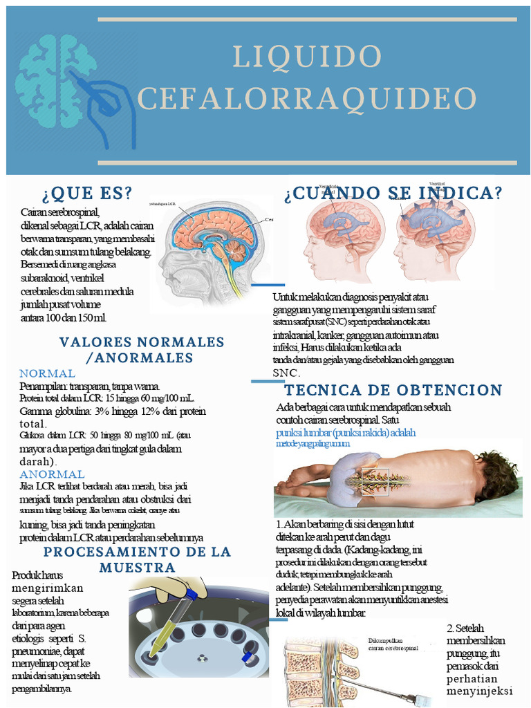 LCR Infografis | PDF