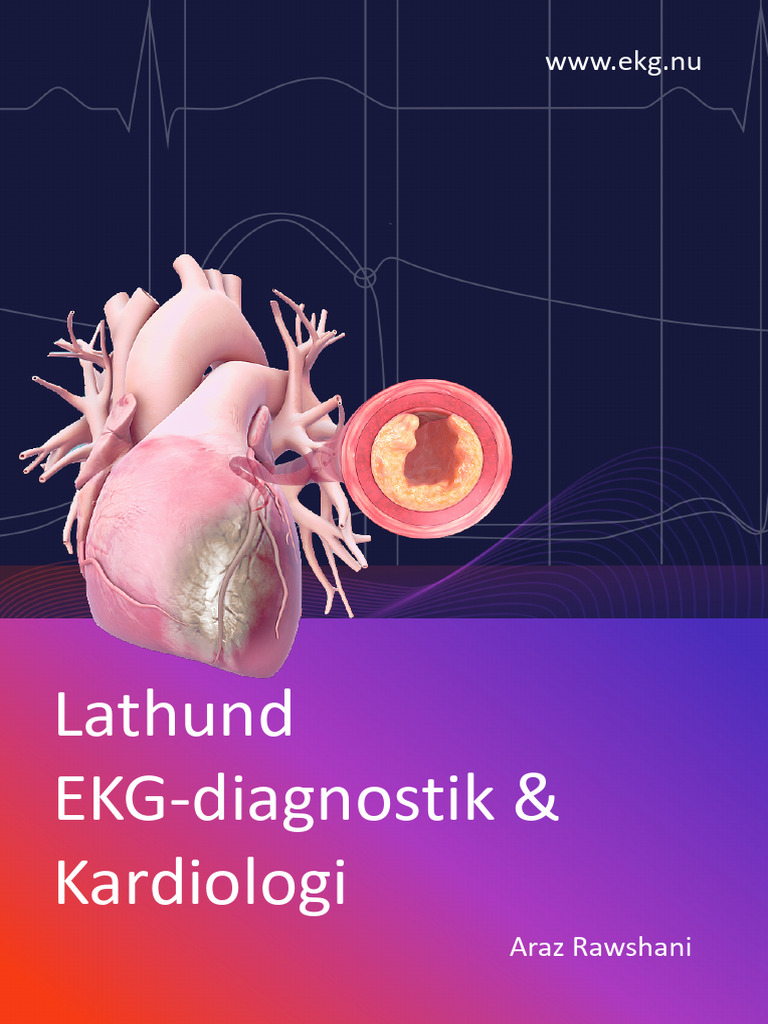 EKG Lathund 2023 | PDF