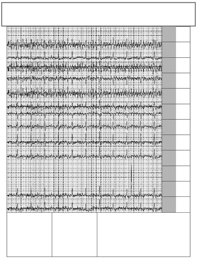 ECG | PDF