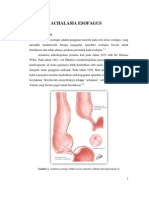 Achalasia Esofagus