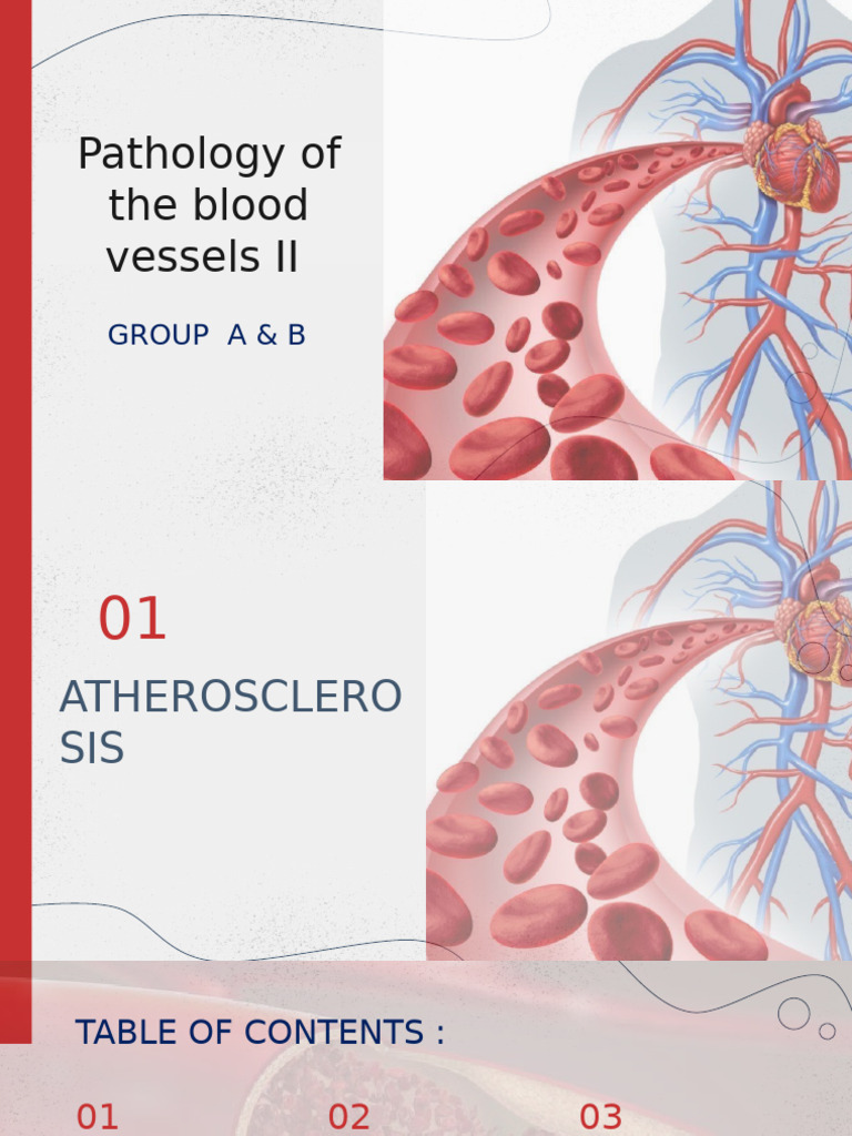 Atherosclerosis: Pathology and Risk Factors | PDF | Atherosclerosis ...