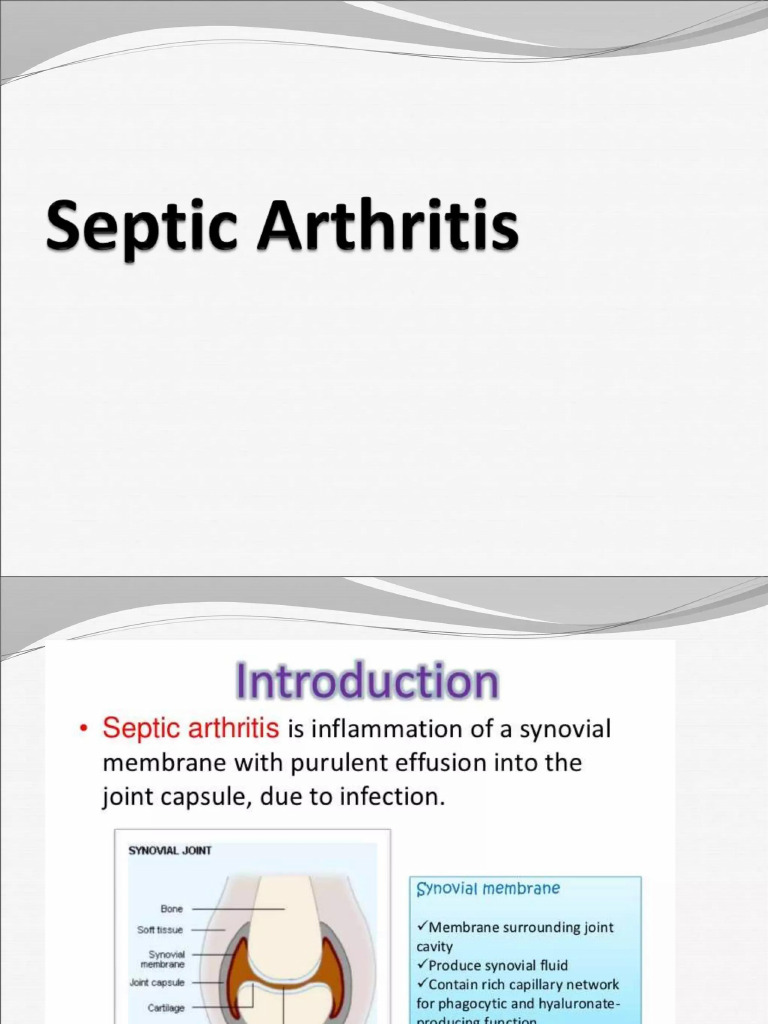Septic Arthritis | PDF