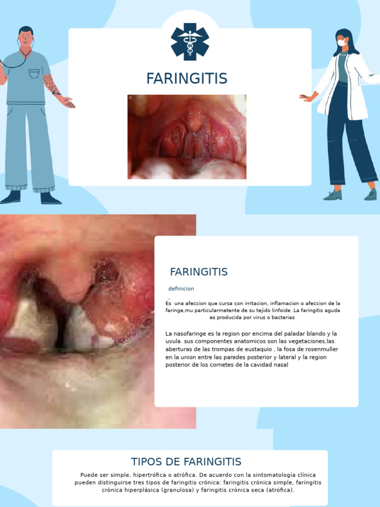 Tipos y Tratamientos de Faringitis | PDF | Enfermedades y trastornos ...