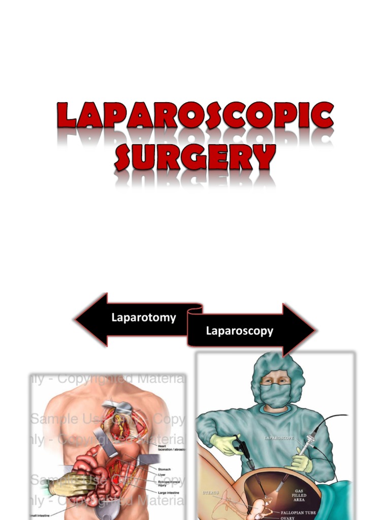 Laparoscopic Surgery Overview and Benefits | PDF | Surgery | Clinical ...