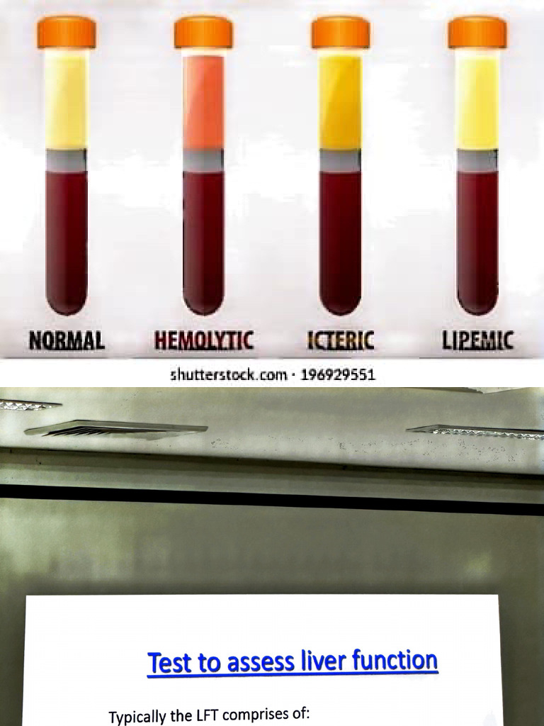 Medical Conditions and Tests Overview | PDF