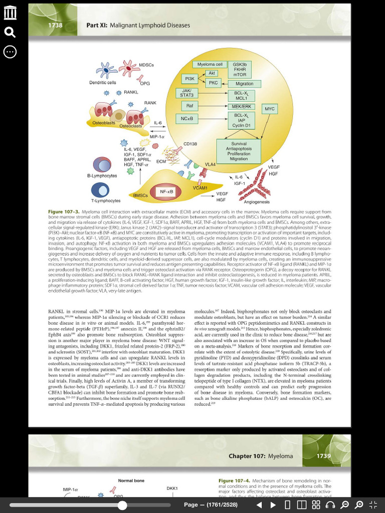 Myeloma and Bone Disease Mechanisms | PDF | Bone | Cell Biology