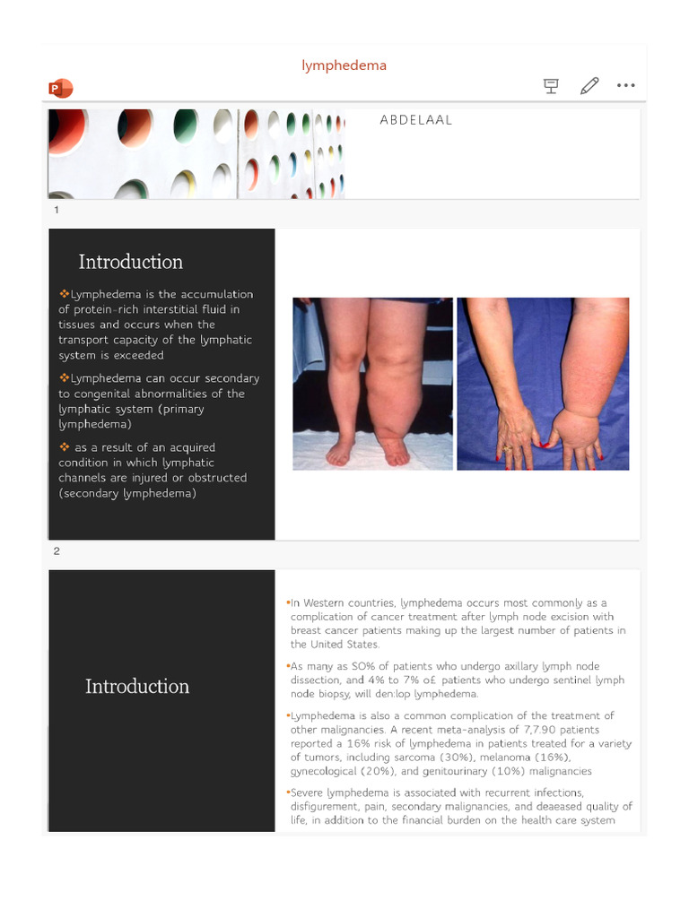 Lymphedema Pdf