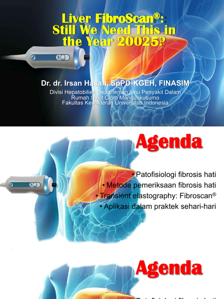 FibroScan®: Evaluasi Fibrosis Hati Non-Invasif | PDF | Cirrhosis ...