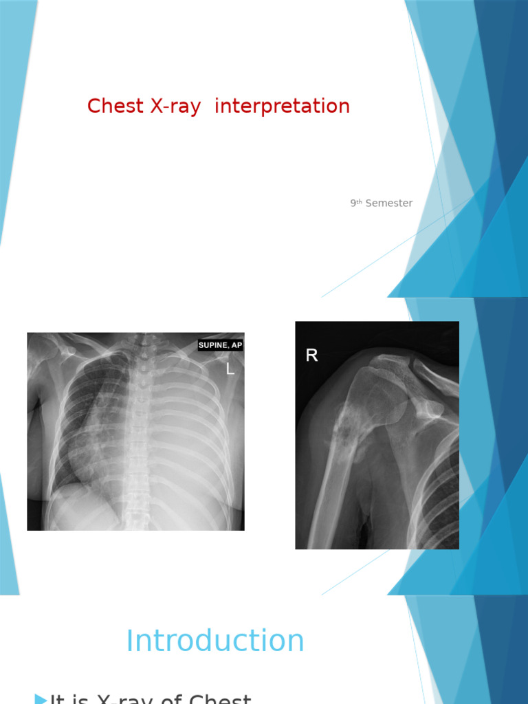 Chest X-Ray Interpretation Guide | PDF | Lung | Heart
