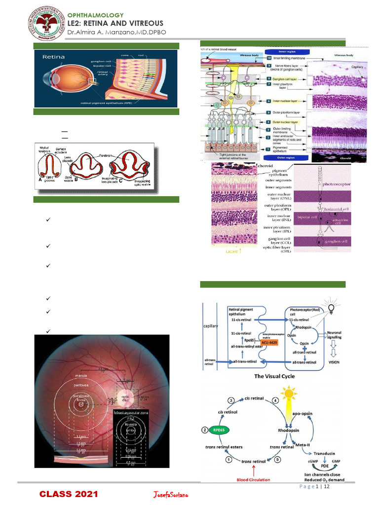 3 2 Part12 Diseases of Retina Vitreous and Optic Nerve Part12 1 | PDF ...