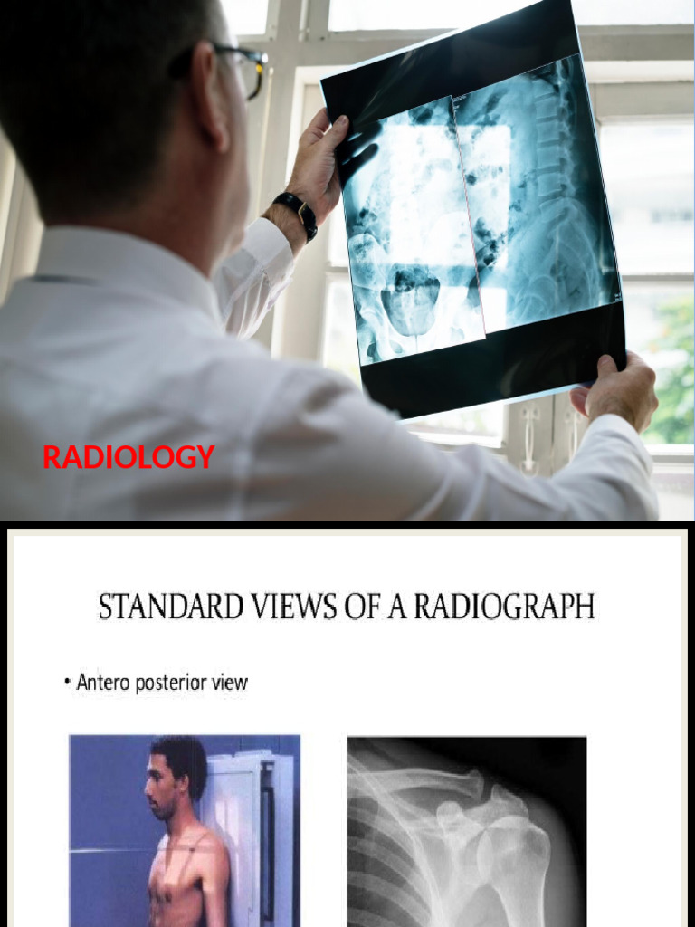 X-Ray Interpretation Guide | PDF